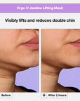 Cryo V-Sculpt Jawline Lifting Mask