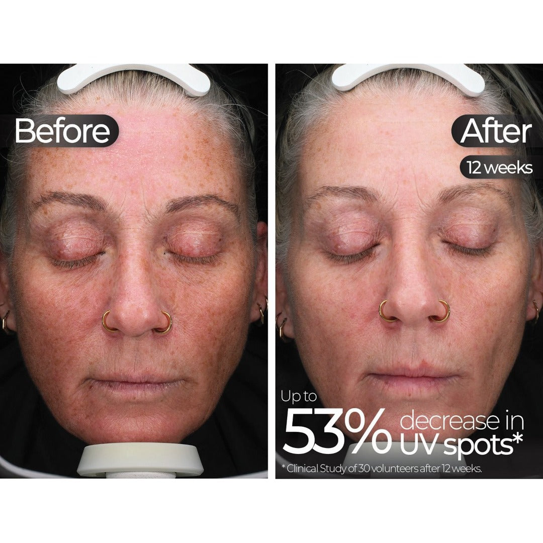 Wavelength Pro 5-in-1 LED Mask