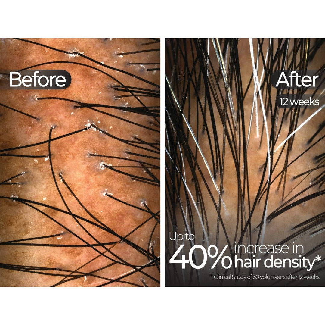 Wavelength Pro 5-in-1 LED Mask