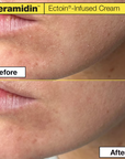 Ceramidin Ectoin-Infused Cream