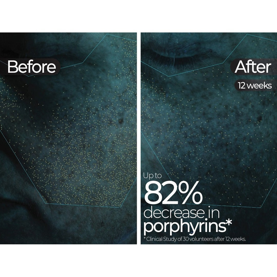 Wavelength Pro 5-in-1 LED Mask