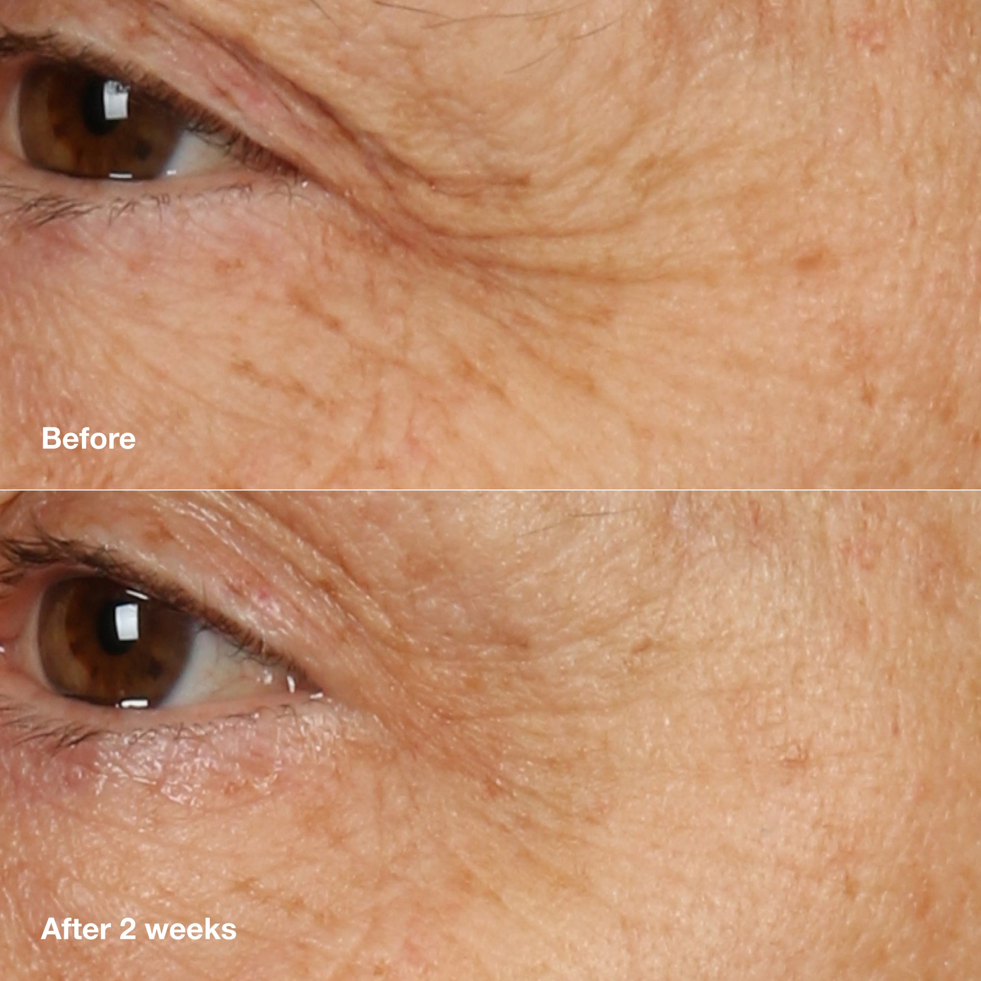 Smart Clinical Repair Overnight Cream + Mask