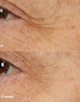Smart Clinical Repair Overnight Cream + Mask