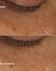 All About Eyes Brightening Serum Concentrate