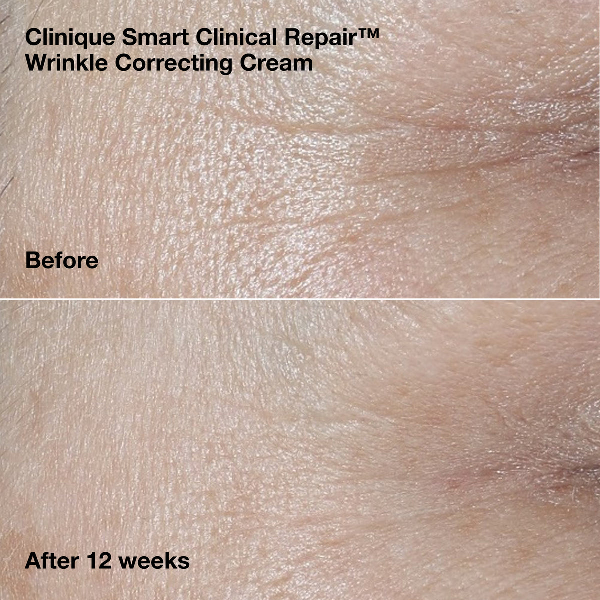 Wrinkle-Correcting Routine Set