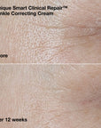 Wrinkle-Correcting Routine Set