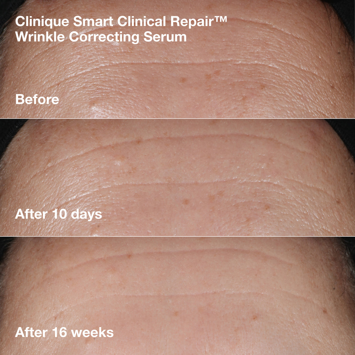 Wrinkle-Correcting Routine Set