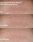 Wrinkle-Correcting Routine Set