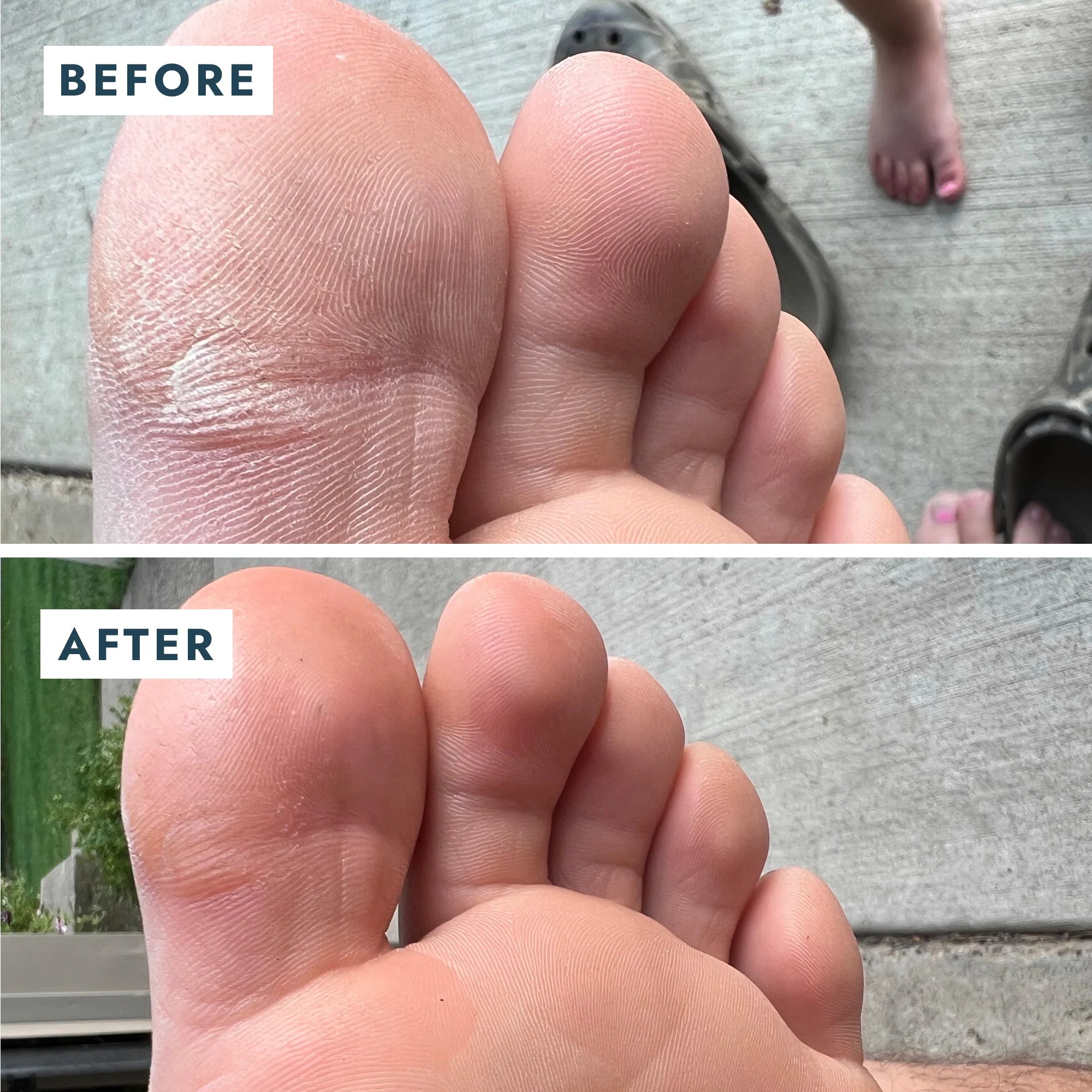 SoleMate Heel Repair Balm