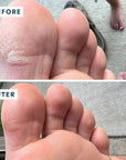 SoleMate Heel Repair Balm