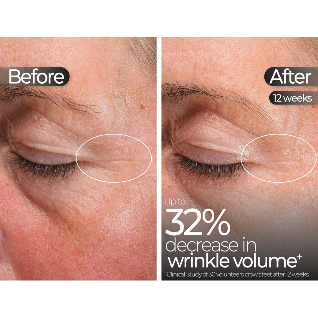 Wavelength Pro 5-in-1 LED Mask