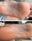 SoleMate Heel Repair Balm