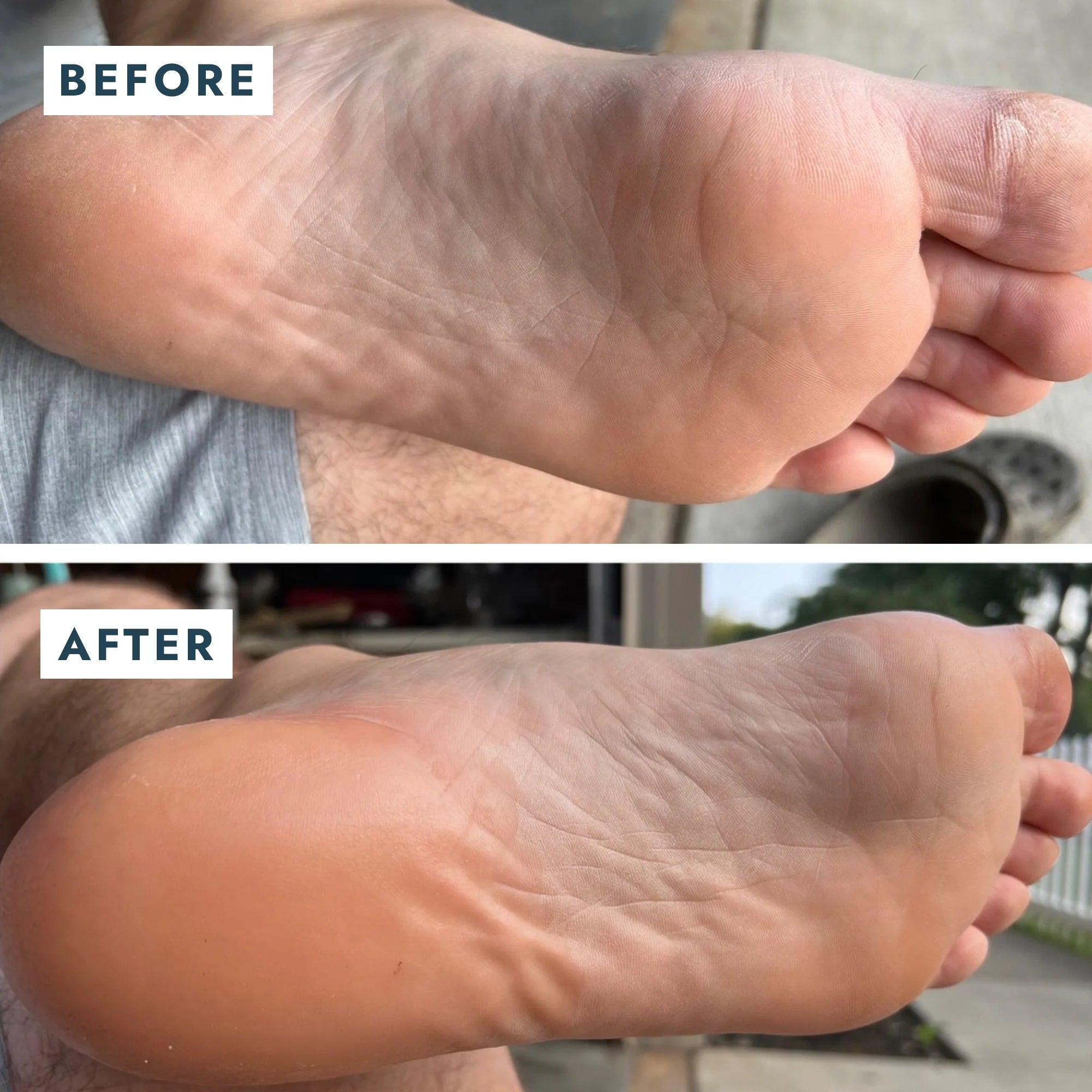 SoleMate Repair Duo