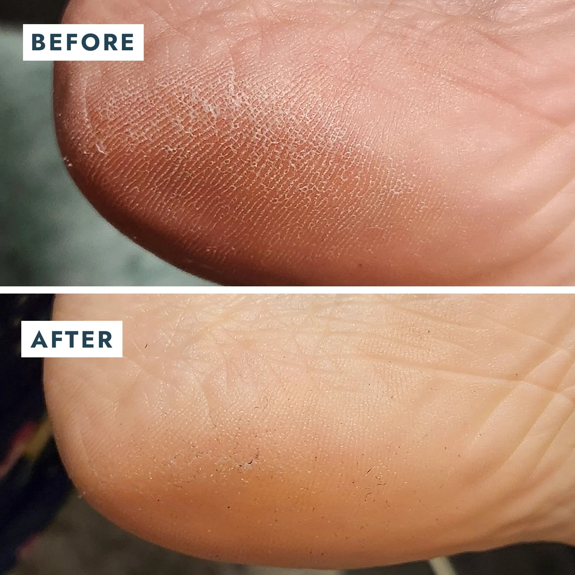 SoleMate Repair Duo
