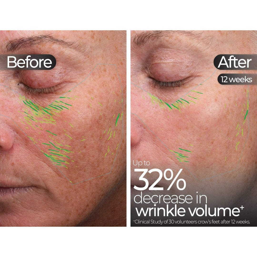 Wavelength Pro 5-in-1 LED Mask