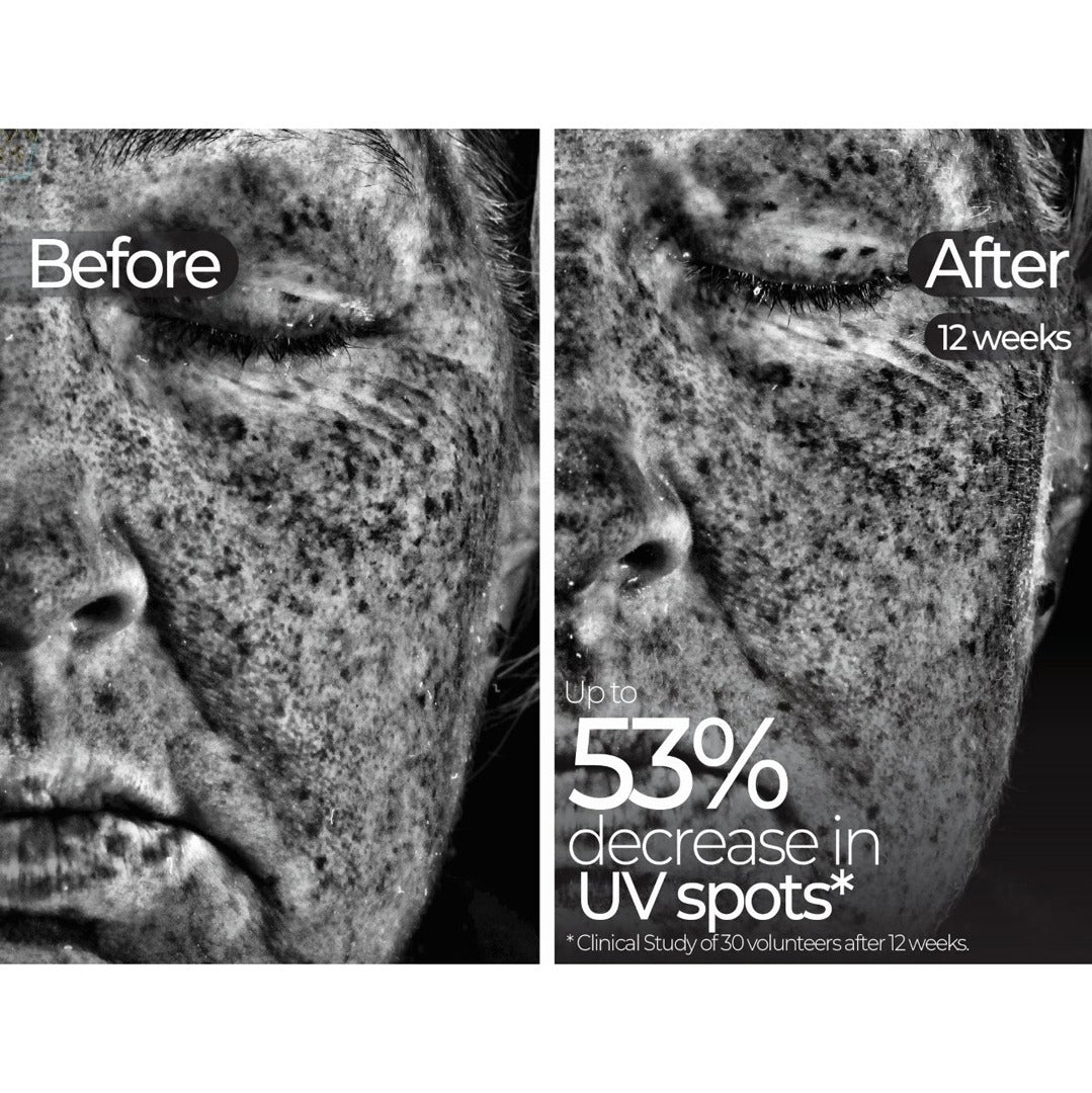 Wavelength Pro 5-in-1 LED Mask