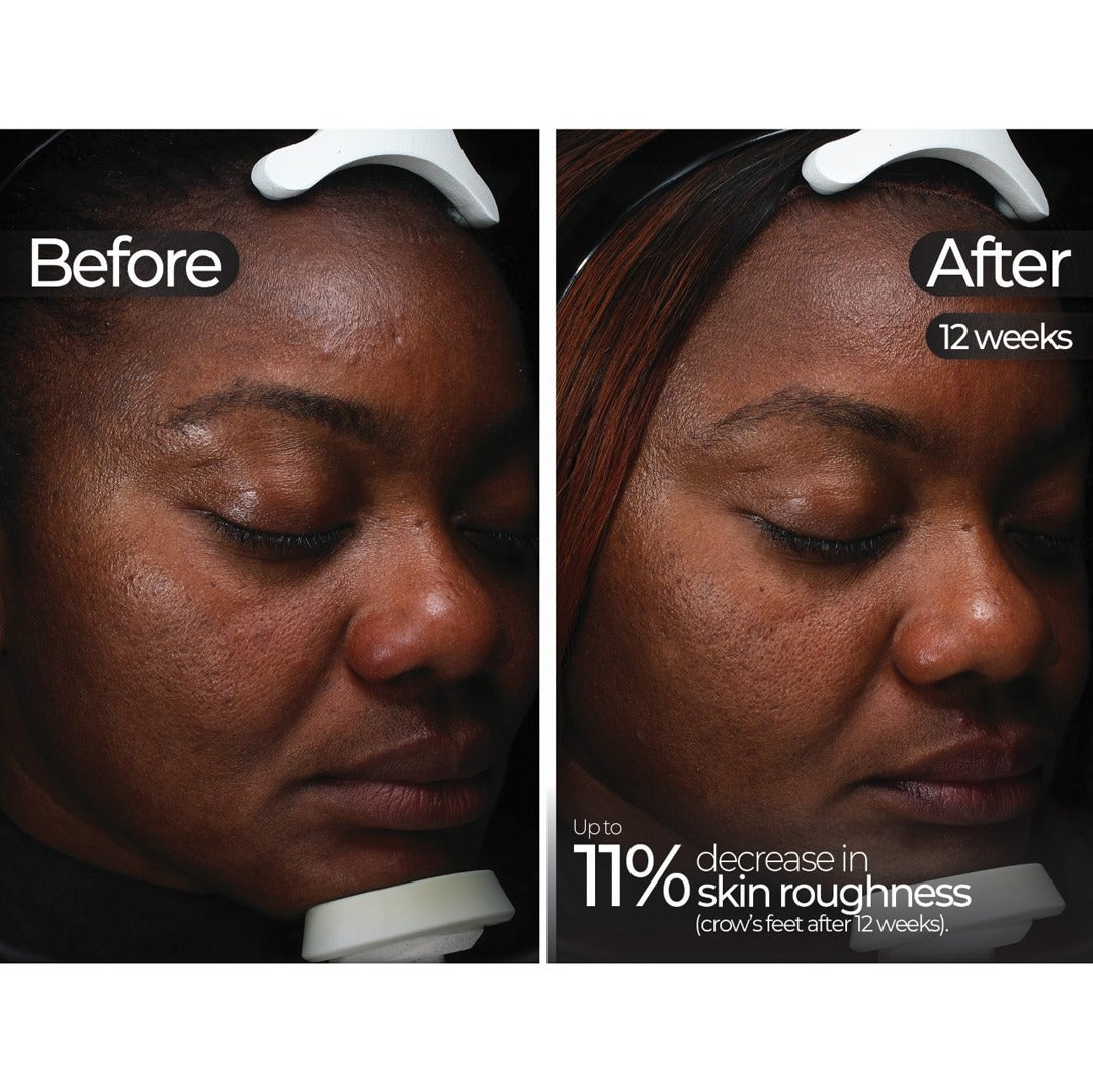 Wavelength Pro 5-in-1 LED Mask