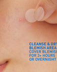 Blemish Control Barrier Patches
