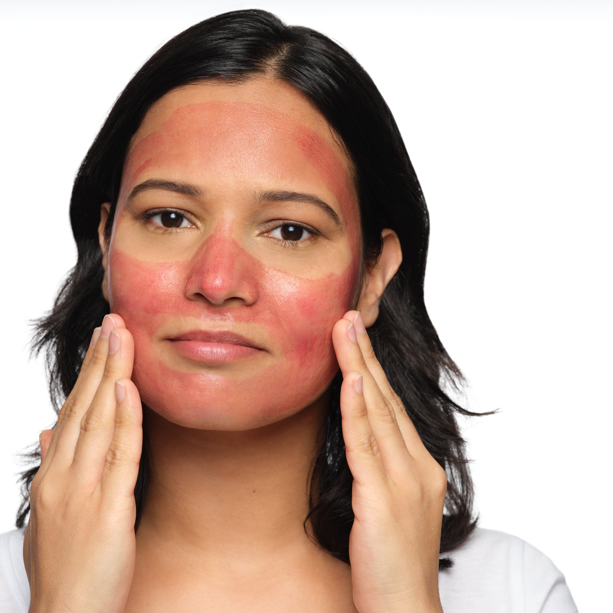 AHA 30% + BHA 2% Peeling Solution