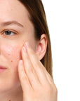 Salicylic Acid 2% Anhydrous Solution