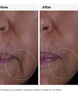 GF 15% Solution Serum