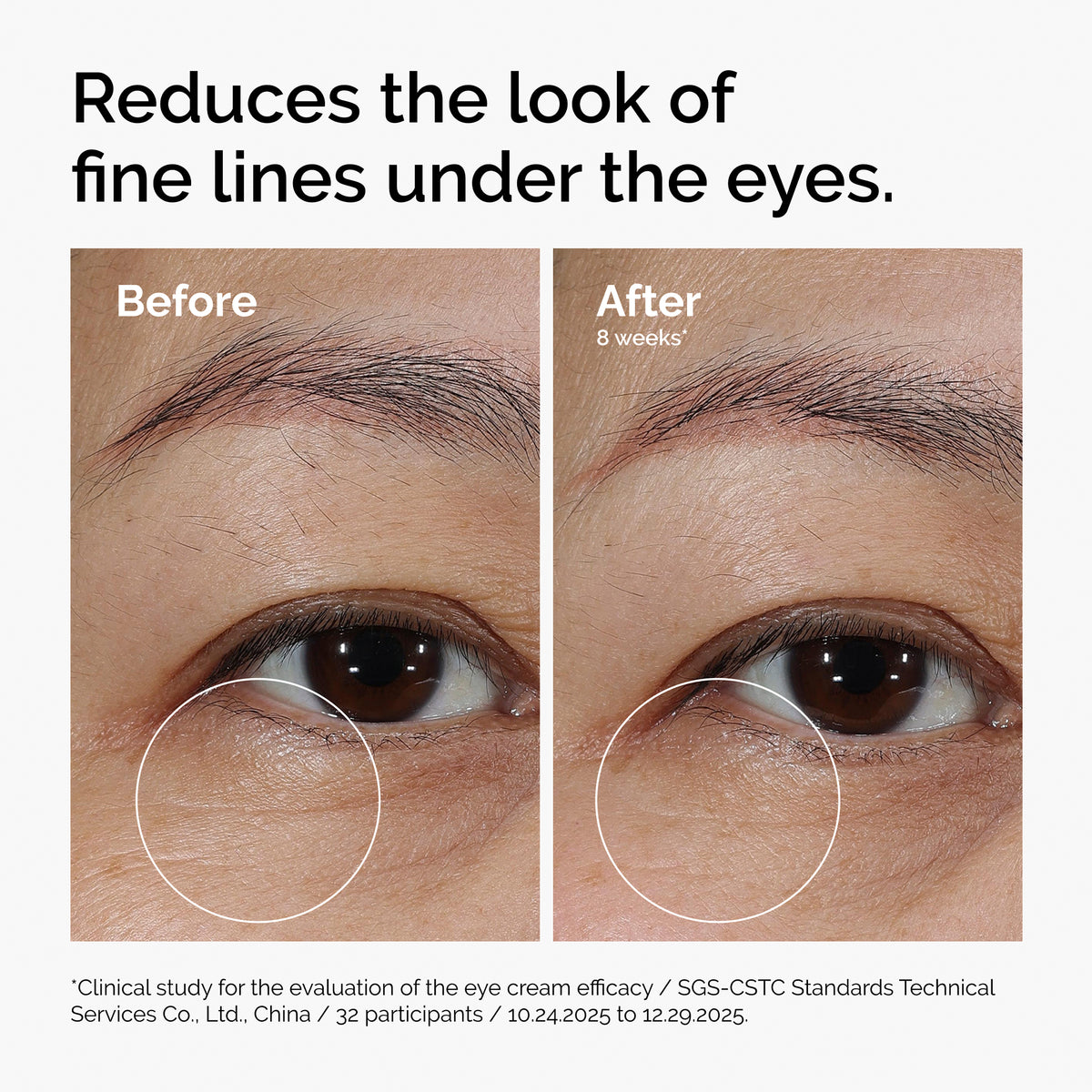 Lacto-PDRN* 4% + B9 Eye Cream