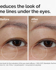 Lacto-PDRN* 4% + B9 Eye Cream