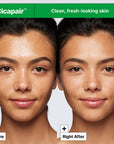 Cicapair Gentle Cleansing Foam