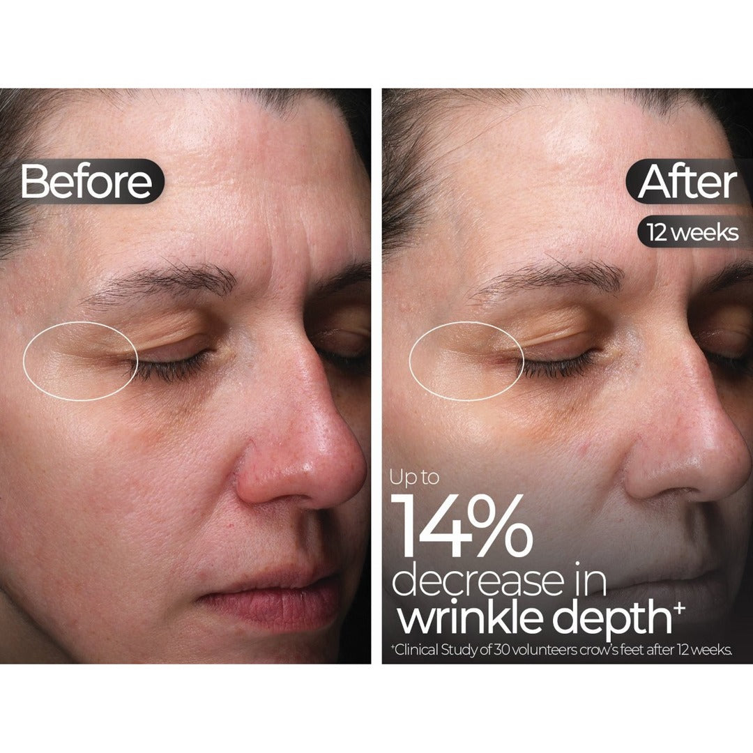 Wavelength Pro 5-in-1 LED Mask