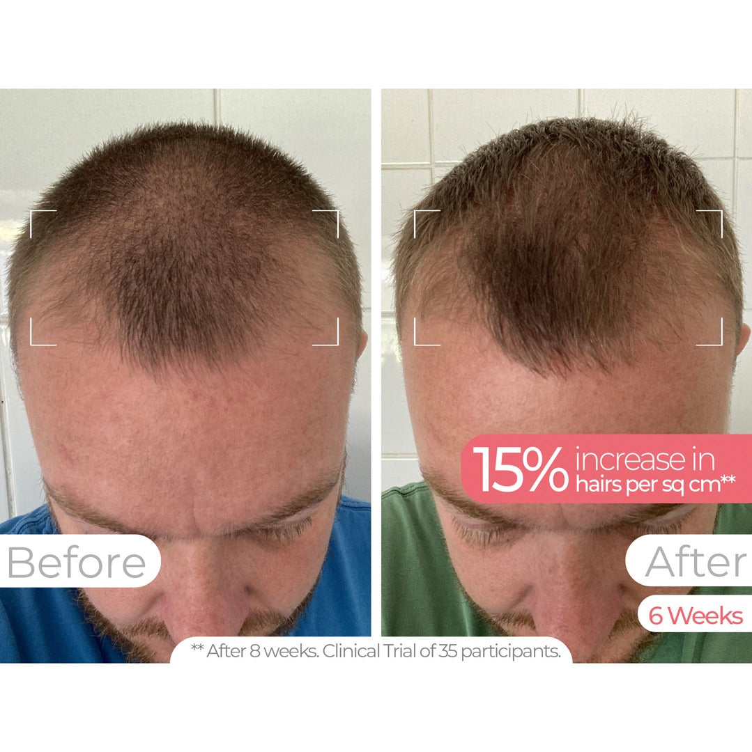 Wavelength Pro 5-in-1 LED Mask