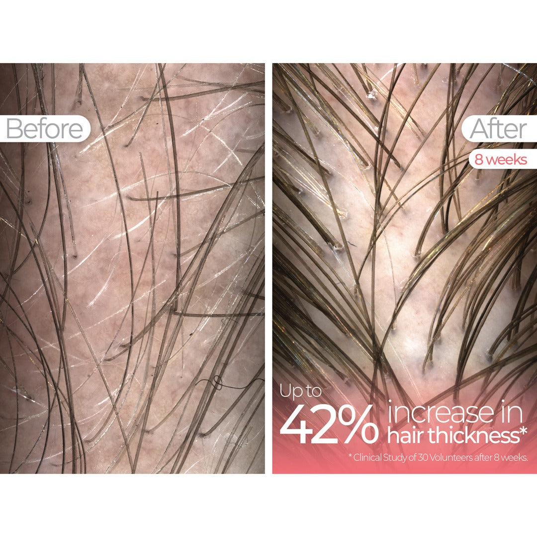 Wavelength Pro 5-in-1 LED Mask