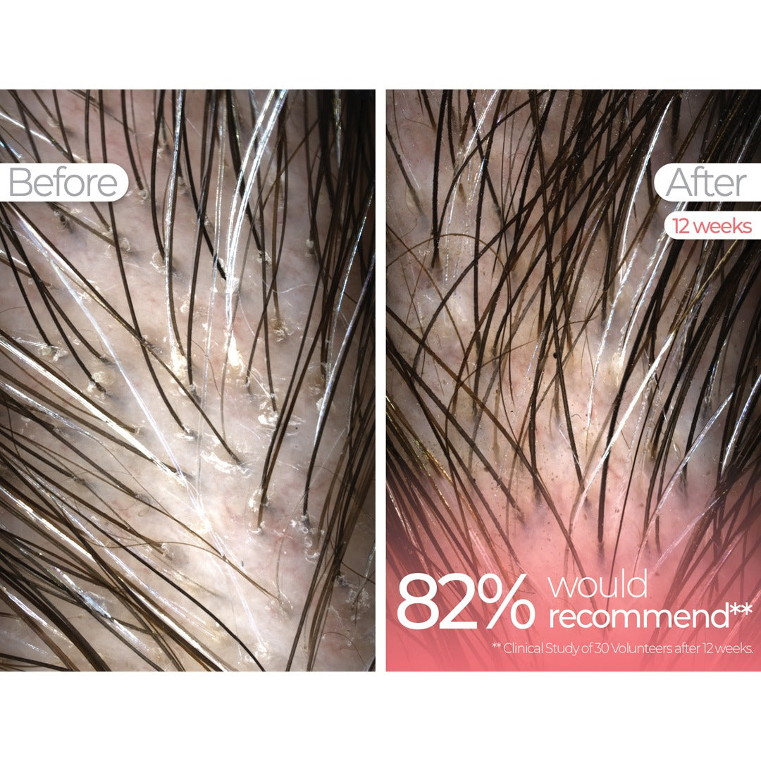 Wavelength Pro 5-in-1 LED Mask