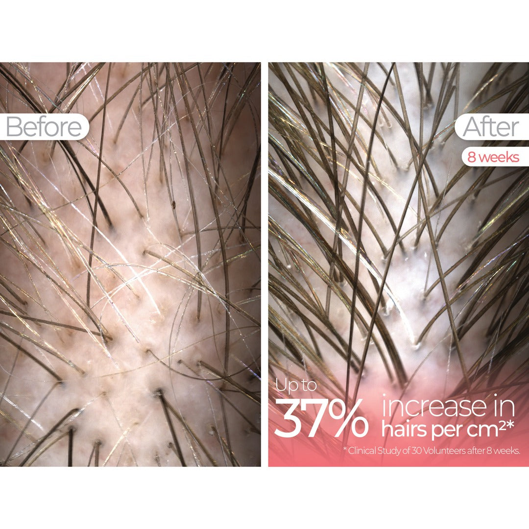 Wavelength Pro 5-in-1 LED Mask