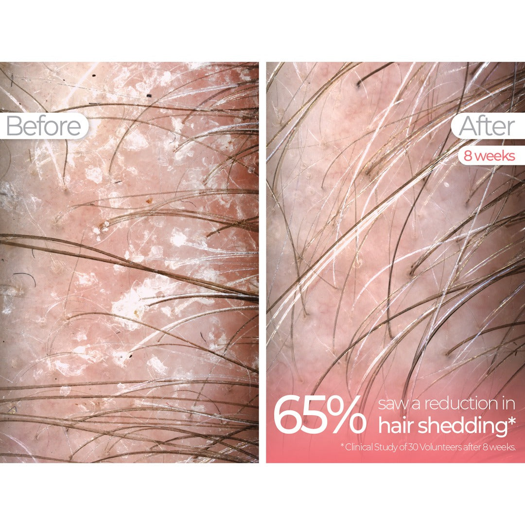 Wavelength Pro 5-in-1 LED Mask