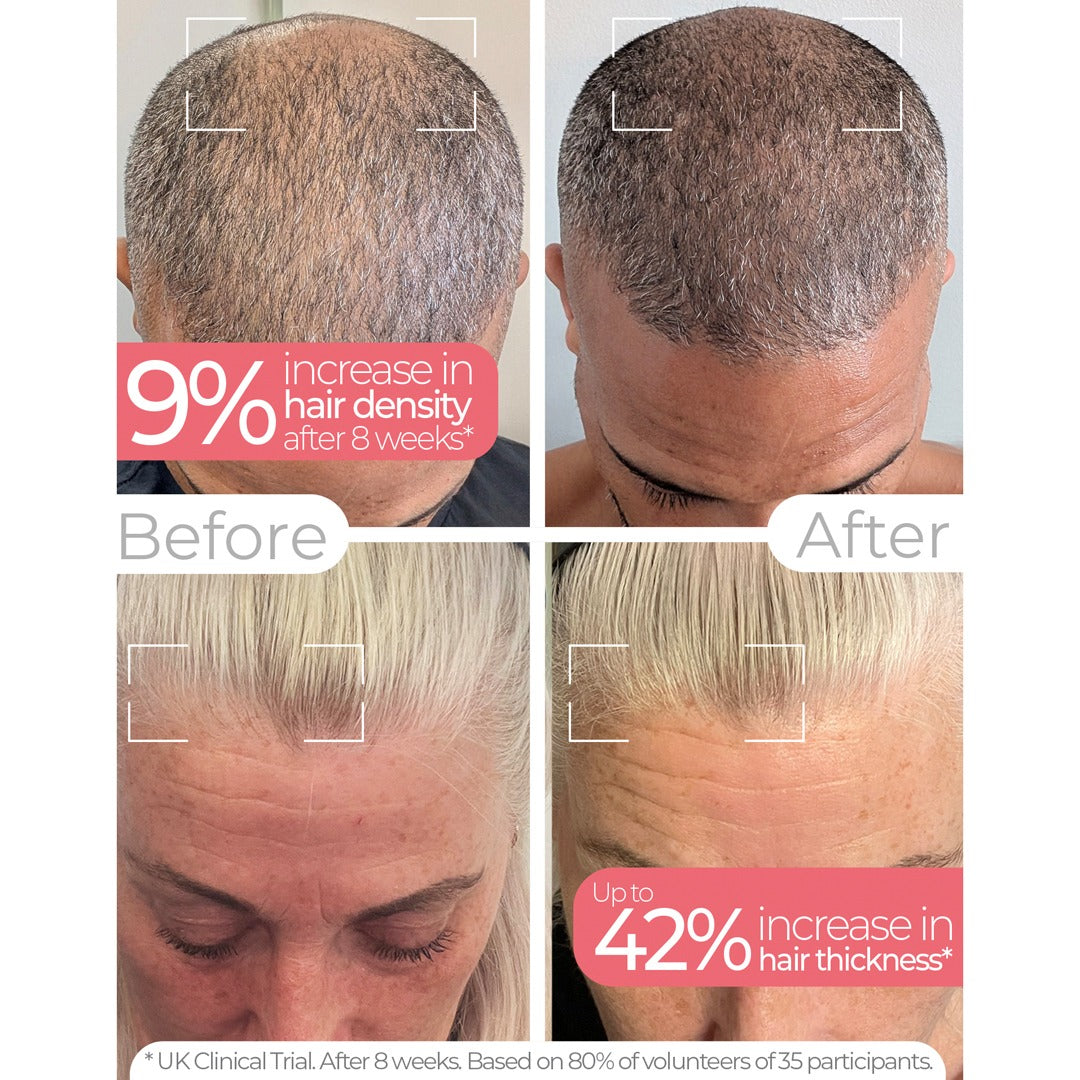 Wavelength Pro 5-in-1 LED Mask