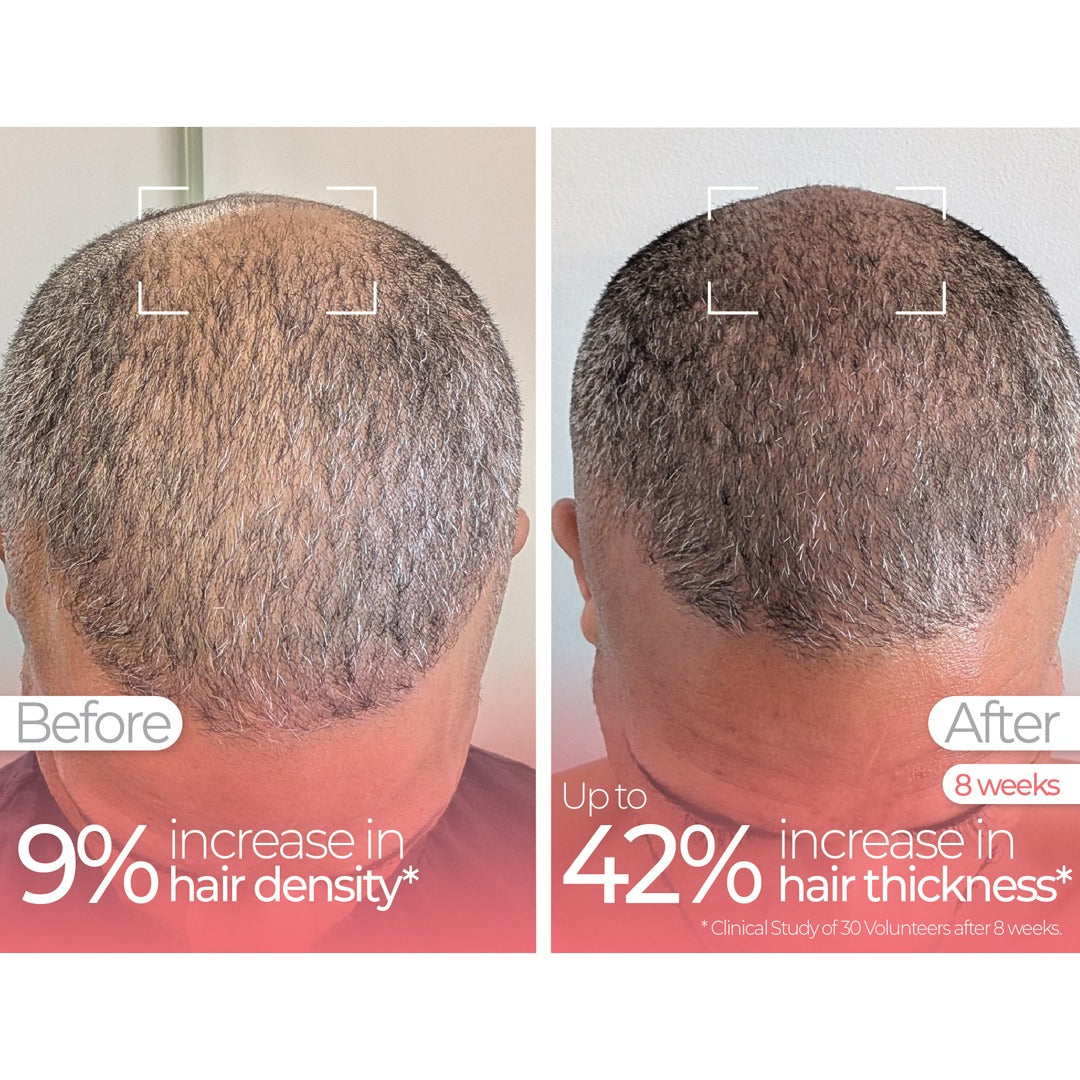 Wavelength Pro 5-in-1 LED Mask