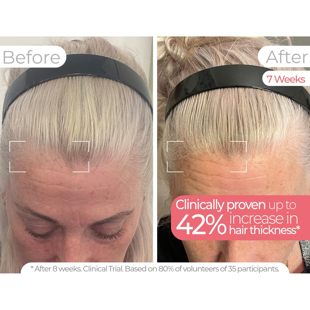 Wavelength Pro 5-in-1 LED Mask