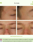 Centella Calming AC Spot Cream